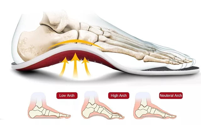 Orthopädische Einlegesohlen | FußFit